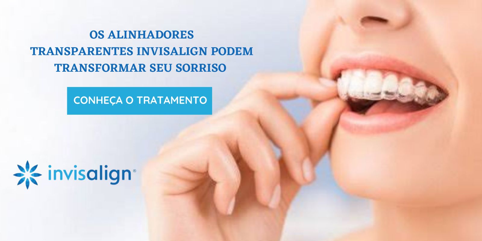 Invisalign Teste